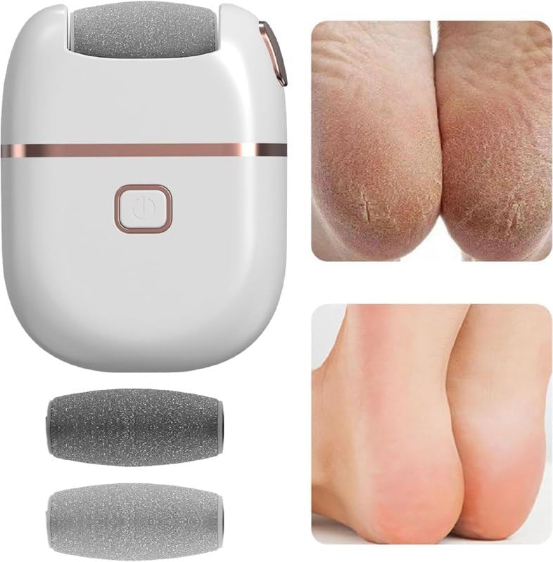 Electric Callus Remover - DanishHubGardening Products